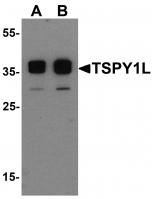 Western blot analysis of TSPY1L in A20 cell lysate with TSPY1L antibody at (A) 0.5 and (B) 1 ug/mL