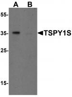 Western blot analysis of TSPY1S in A20 cell lysate with TSPY1S antibody at 1 ug/mL in (A) the absence and (B) the presence of blocking peptide.