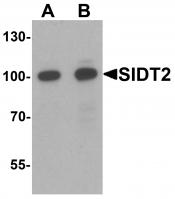 Western blot analysis of SIDT2 in mouse brain tissue lysate with SIDT2 antibody at (A) 0.5 and (B) 1 ug/mL.