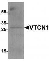 Western blot analysis of VTCN1 in EL4 cell lysate with VTCN1 antibody at 1 ug/mL.