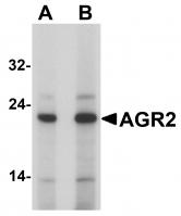 Gel: 8%SDS-PAGE<br>Lysate: 40 μg<br>Lane 1-2: 293T cells<br>hela cells<br>Primary antibody: TA350730 (ACP2 Antibody) at dilution 1/400<br>Secondary antibody: Goat anti rabbit IgG at 1/8000 dilution<br>Exposure time: 3 minutes
