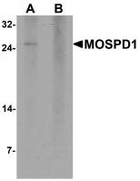 Western blot analysis of MOSPD1 in human brain tissue lysate with MOSPD1 antibody at 1 ug/mL in (A) the absence and (B) the presence of blocking peptide.