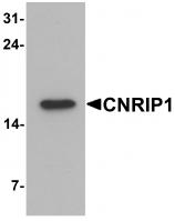 Western blot analysis of CNRIP1 in human brain tissue lysate with CNRIP1 antibody at 1 ug/mL.