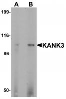 Western blot analysis of KANK3 in A431 cell lysate with KANK3 antibody at (A) 1 and (B) 2 ug/mL.