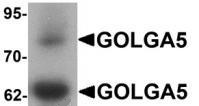 Western blot analysis of GOLGA5 in human testis tissue lysate with GOLGA5 antibody at 1 ug/mL.
