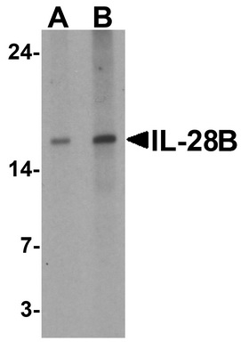 Western blot analysis of IL-28B in HeLa cell lysate with IL-28B antibody at (A) 1 and (B) 2 ug/ml.