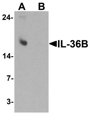 Western blot analysis of IL-36B in A549 cell lysate with IL-36B antibody at 1 ug/ml in (A) the absence and (B) the presence of blocking peptide.