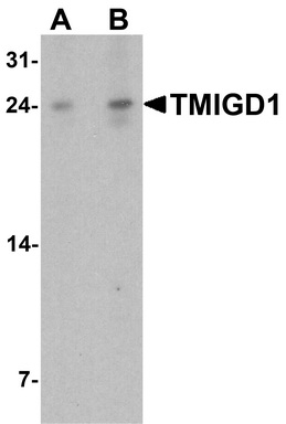 Western blot analysis of TMIGD1 in rat liver tissue lysate with TMIGD1 antibody at (A) 1 and (B) 2 ug/ml.