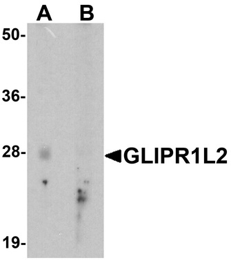 Western blot analysis of GLIPR1L2 in human testis tissue lysate with GLIPR1L2 antibody at 1 ug/ml in (A) the absence and (B) the presence of blocking peptide.