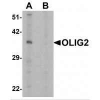 Western blot analysis of extracts from normal (control) and [KO Validated] IRF3 Rabbit pAb knockout (KO) HeLa cells, using [KO Validated] IRF3 Rabbit pAb antibody (TA377566) at 1:1000 dilution.|Secondary antibody: HRP Goat Anti-Rabbit IgG (H+L) at 1:10000 dilution.|Lysates/proteins: 25ug per lane.|Blocking buffer: 3% nonfat dry milk in TBST.|Detection: ECL Basic Kit .|Exposure time: 1s.