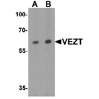 Western blot analysis of VEZT in 293 cell lysate with VEZT antibody at (A) 1 and (B) 2 ug/mL.