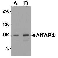 Western blot analysis of AKAP4 in human testis tissue lysate with AKAP4 antibody at (A) 1 and (B) 2 ug/mL.