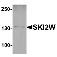 Western blot analysis of SKI2W in mouse stomach tissue lysate with SKI2W antibody at 1 ug/mL.