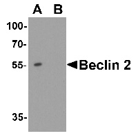 Western blot analysis of Beclin 2 in Jurkat cell lysate with Beclin 2 antibody at 1 ug/mL in (A) the absence and (B) the presence of blocking peptide.