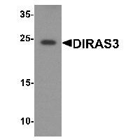 Western blot analysis of DIRAS3 in human testis tissue lysate with DIRAS3 antibody at 1 ug/mL.