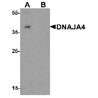 Western blot analysis of DNAJA4 in human colon tissue lysate with DNAJA4 antibody at 1 ug/mL in (A) the absence and (B) the presence of blocking peptide.