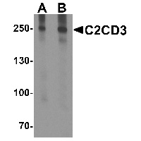 Western blot analysis of C2CD3 in EL4 cell lysate with C2CD3 antibody at (A) 1 and (B) 2 ug/mL.