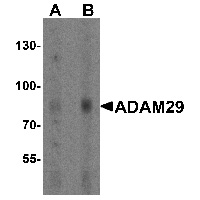 Western blot analysis of ADAM29 in human bladder tissue lysate with ADAM29 antibody at (A) 1 and (B) 2 ug/mL.