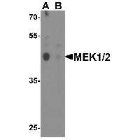 Western blot analysis of MEK1/2 in human brain tissue lysate with MEK1/2 antibody at 1 ug/mL in (A) the absence and (B) the presence of blocking peptide.