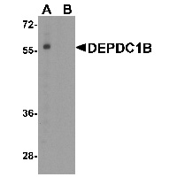 Western blot analysis of DEPDC1B in K562 cell lysate with DEPDC1B antibody at 1 ug/mL in (A) the absence and (B) the presence of blocking peptide.