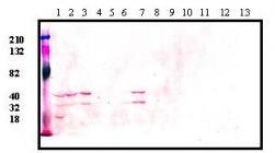 Western blot analysis of TSPY1 expression 14 different human cell lines from lane 1 to 14: Lung (A549); a Retinoblastoma cell line; Bone (TUSO2); Cervical (HeLa); Fibrosarcoma (HT1080); Breast (MDA_MB-468); Nuroblastoma (Sy5y); Liver (Hep3B); Placenta (JEG-13); Lymphoma (Jurkat); SKOV3; Prostate (PC-3); Ovary (Ovcar3); Colon (HT29). The top band (36 kDa) indicates the position of TSPY1 protein.