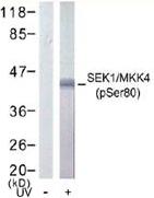 Western blot analysis of extracts from 293 cells untreated or treated with UV, using SEK1/MKK4 (phospho-Ser80) antibody.