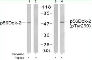 Western blot analysis of extracts from K562 cells using p56Dok-2 antibody (Lanes 1 and 2) and p56Dok-2 (phospho-Tyr299) antibody (Lanes 3 and 4).
