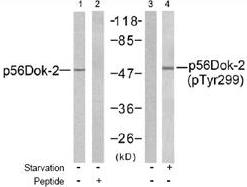 Western blot analysis of extracts from K562 cells, using p56Dok-2 antibody (Lanes 1 and 2) and p56Dok-2 (phospho-Tyr299) antibody (Lanes 3 and 4).