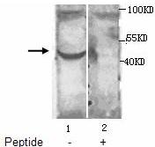 Western blot analysis of fetal heart tissue lysates with ant-ACTR1B antibody at 1:1000 (Lane 1: No peptide blocked; Lane 2: Peptide blocked).