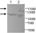 Western blot analysis of human fetal heart (Lane 1) and brain (Lane 2) lysates with anti-ADAMTS3 antibody (1:2000). This antibody identified zymogen form of ADAMTS3 at 140kDa, and activated forms at 94-105kDa.