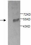 Western blot analysis of fetal intestine lysates with anti-SMPDL3B antibody (1:200). This antibody identified a band of ~52kDa in fetal intestine lysates.