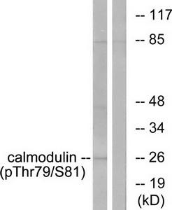 WB Suggested Anti-TUBE1 Antibody Titration: 0.2-1ug/ml; ELISA Titer: 1:312500; Positive Control: Hela cell lysate
