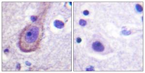 Immunohistochemistry analysis of paraffin-embedded human brain tissue, using Kv7.3/KCNQ3 (Phospho-Thr246) antibody.The picture on the right is treated with the synthesized peptide.