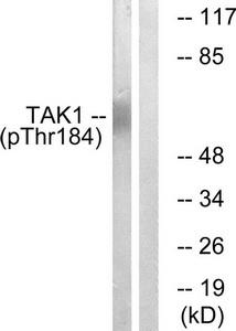 Western blot analysis of extracts from HepG2 cells, treated with TNF (20ng/ml, 5mins), using TAK1 (Phospho-Thr184) antibody.The lane on the right is treated with the synthesized peptide.