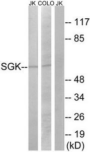 Western blot analysis on 293 cell lysate using E-cadherin Antibody