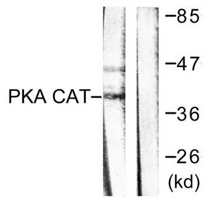 WB was performed on whole cell (25ug, lane 1) and histone extracts (15ug, lane 2 ) from HeLa cells, and on 1ug of recombinant histone H2A, H2B, H3 and H4 (lane 3, 4, 5 and 6, respectively) using the antibody against H3R17me2 (asym) K18ac. The antibody was diluted 1:1,000 in TBS-Tween containing 5% skimmed milk. The marker (in kDa) is shown on the left.
