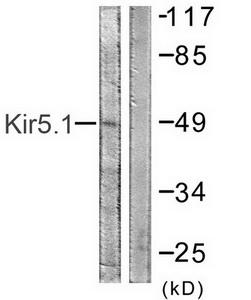 Western blot analysis of extracts from HeLa cells, using Kir5.1 (Ab-416) antibody.The lane on the right is treated with the synthesized peptide.