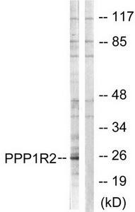 WB using the antibody against H3K9me2 diluted 1:1,000 in TBS-Tween containing 5% skimmed milk. The position of the protein of interest is indicated on the right; the marker (in kDa) is shown on the left.