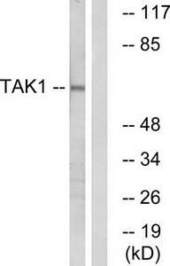 Western blot analysis of extracts from HepG2 cells, using TAK1 (Ab-184) antibody.The lane on the right is treated with the synthesized peptide.