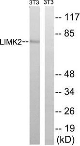 Western blot analysis of extracts from 3T3 cells, treated with PMA (125ng/ml, 30mins), using LIMK2 (Ab-283) antibody.The lane on the right is treated with the synthesized peptide.