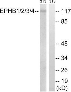 WB Suggested Anti-TPI1 Antibody Titration: 0.2-1ug/ml; Positive Control: HepG2 cell lysate