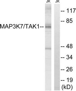 Western blot analysis of extracts from Jurkat cells, treated with heat shock, using MAP3K7 (Ab-187) antibody.The lane on the right is treated with the synthesized peptide.