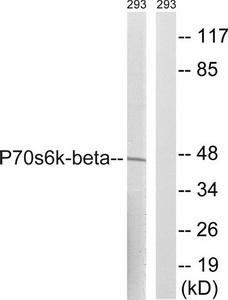 Western blot analysis of extracts from 293 cells, using p70 S6 Kinase. (Ab-423) antibody.The lane on the right is treated with the synthesized peptide.
