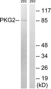 Determination of the antibody titer To determine the titer of the antibody, an ELISA was performed using a serial dilution of the antibody against H4K5, 8, 12, 16ac in antigen coated wells. The antigen used was a peptide containing the histone modification of interest. By plotting the absorbance against the antibody dilution (Figure 3), the titer of the antibody was estimated to be 1:21, 200.