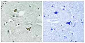 Immunohistochemistry analysis of paraffin-embedded human brain tissue using Girdin antibody.The picture on the right is treated with the synthesized peptide.
