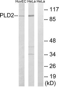 WB with the antibody against H3K9me3S10p diluted 1:500 in TBS-Tween containing 5% skimmed milk. The position of the protein of interest is indicated on the right; the marker (in kDa) is shown on the left. The result of the Western analysis with the antibody is shown in lane 2; lane 1 shows the same analysis after incubation of the antibody with 5 nmol blocking peptide for 1 hour at room temperature.