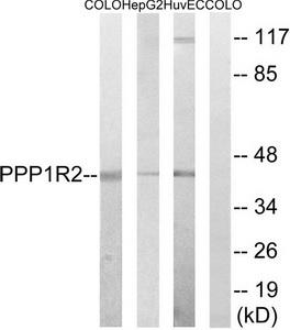 WB using the antibody against H3K36me3 diluted 1:1,000 in TBS-Tween containing 5% skimmed milk. The position of the protein of interest is indicated on the right; the marker (in kDa) is shown on the left.