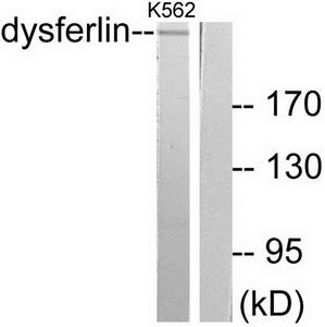 Western blot analysis of extracts from K562 cells, using Dysferlin antibody.The lane on the right is treated with the synthesized peptide.
