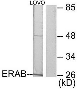 Western blot analysis of extracts from LOVO cells, using ERAB antibody.The lane on the right is treated with the synthesized peptide.