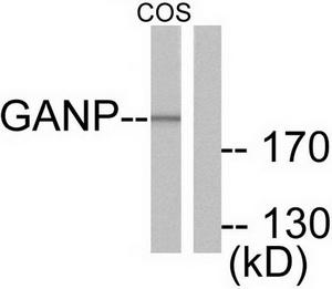 Western blot analysis of extracts from NIH/3T3 cells, using GANP antibody (#TA314829).The lane on the right is treated with the synthesized peptide.